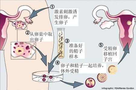 人工孕妈代怀咨询联系电话